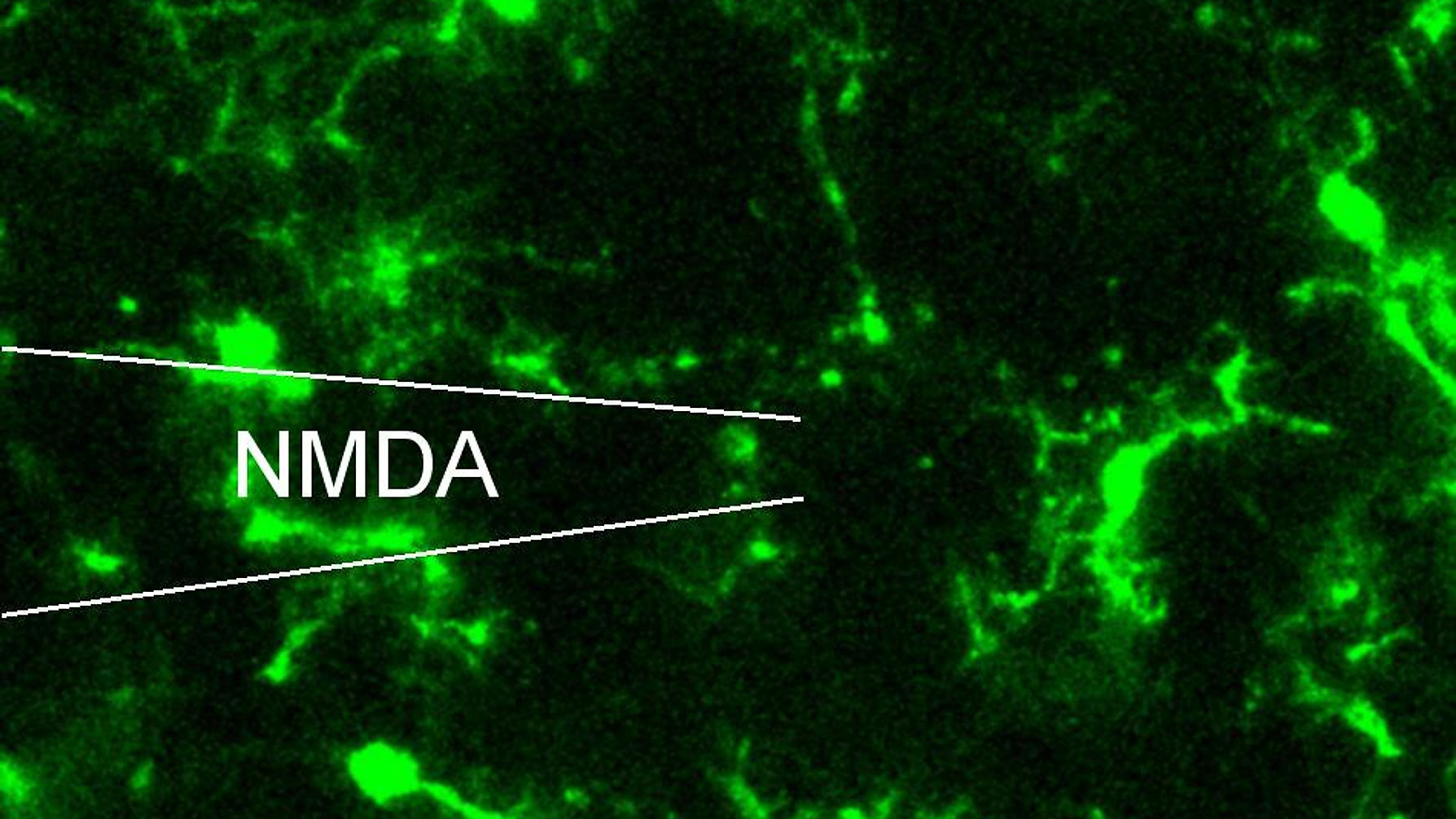 Microglia Respond by Chemotaxis to ATP but not NMDA